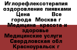 Иглорефлексотерапия, оздоровление пиявками › Цена ­ 3 000 - Все города, Москва г. Медицина, красота и здоровье » Медицинские услуги   . Свердловская обл.,Красноуральск г.